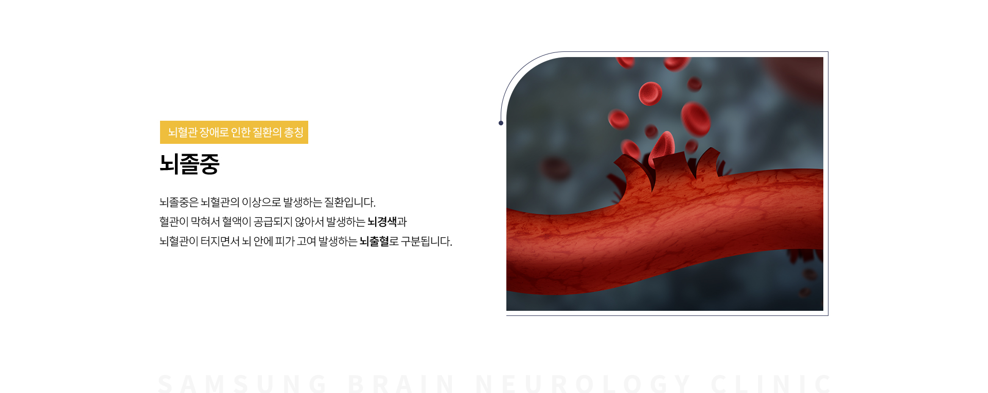뇌신경질환클리닉